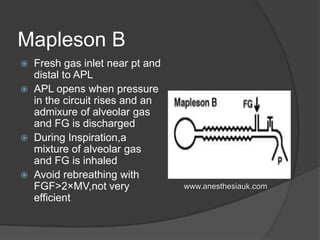 Mapleson B
Fresh gas inlet near pt and
distal to APL
 APL opens when pressure
in the circuit rises and an
admixure of alveolar gas
and FG is discharged
 During Inspiration,a
mixture of alveolar gas
and FG is inhaled
 Avoid rebreathing with
FGF>2×MV,not very
efficient


www.anesthesiauk.com

 