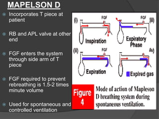 MAPELSON D


Incorporates T piece at
patient



RB and APL valve at other
end



FGF enters the system
through side arm of T
piece



FGF required to prevent
rebreathing is 1.5-2 times
minute volume



Used for spontaneous and
controlled ventilation

 