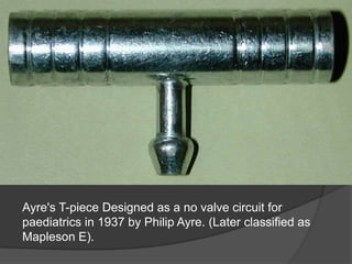 Ayre's T-piece Designed as a no valve circuit for
paediatrics in 1937 by Philip Ayre. (Later classified as
Mapleson E).

 