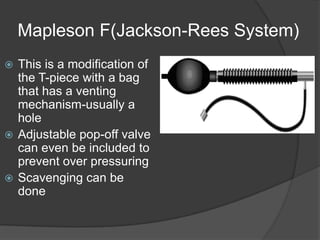 Mapleson F(Jackson-Rees System)
This is a modification of
the T-piece with a bag
that has a venting
mechanism-usually a
hole
 Adjustable pop-off valve
can even be included to
prevent over pressuring
 Scavenging can be
done


 