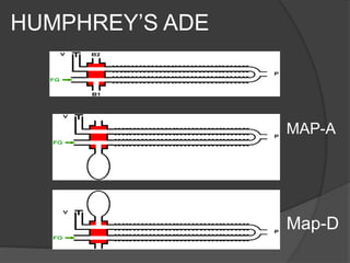 HUMPHREY’S ADE

MAP-A

Map-D

 