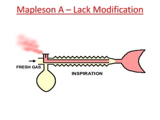 Mapleson A – Lack Modification
 