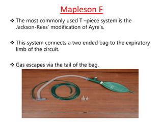 Mapleson F
 The most commonly used T –piece system is the
Jackson-Rees’ modification of Ayre’s.
 This system connects a two ended bag to the expiratory
limb of the circuit.
 Gas escapes via the tail of the bag.
 