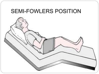 SEMI-FOWLERS POSITION
 