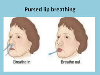 Pursed lip breathing
 