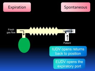 Expiration Spontaneous
IUDV opens returns
back to position
EUDV opens the
expiratory port
Fresh
gas flow
Patient
 