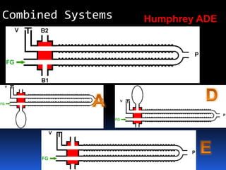 Humphrey ADECombined Systems
 