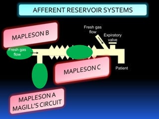 v
AFFERENT RESERVOIR SYSTEMS
Patient
Fresh gas
flow
Fresh gas
flow
Expiratory
valve
 