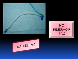 NO
RESERVOIR
BAG
 