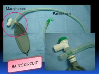 Machine end
Patient end
 