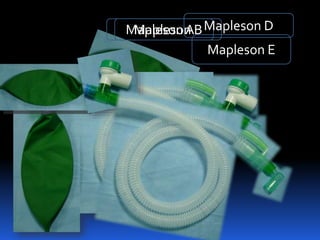 MaplesonAMapleson B
Mapleson C
Mapleson D
Mapleson E
 