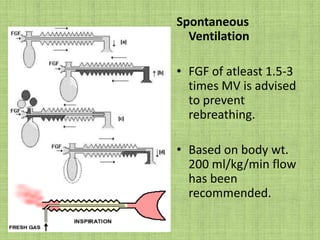 Mapleson C systemAlso called as Westminster face pieceFGF > 2 x Min Volume for both Spontaneous & controlled.Used for short periods during transportation of patient.