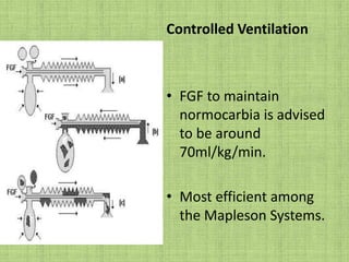 Enclosed Afferent Reservoir SystemDescribed by Miller & Miller.Consists of Mapleson A system enclosed within a non-distensible structureSpontaneous ventilation  variable orifice kept open, behaves like Mapleson A.Controlled ventilation  variable orifice partially closed.It is more efficient than Bain`s system when FG is > than Alveolar Ventilation.