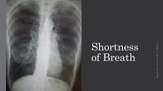 Shortness
of Breath
PhotobyJamesHeilman,MD/CCBY-SA3.0
 