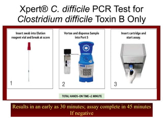 Xpert ®   C. difficile  PCR Test for  Clostridium difficile  Toxin B Only Results in an early as 30 minutes; assay complete in 45 minutes If negative 