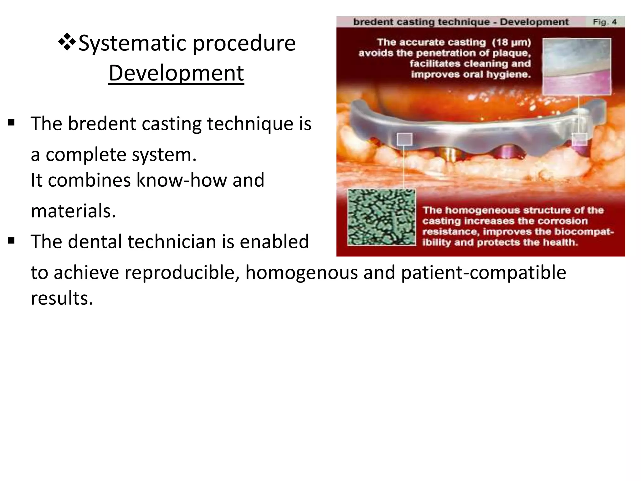Systematic procedure
Development
 The bredent casting technique is
a complete system.
It combines know-how and
materials.
 The dental technician is enabled
to achieve reproducible, homogenous and patient-compatible
results.
 