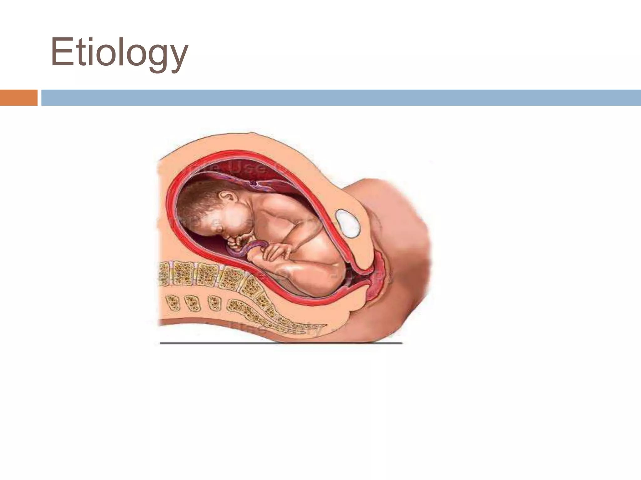 Etiology
 