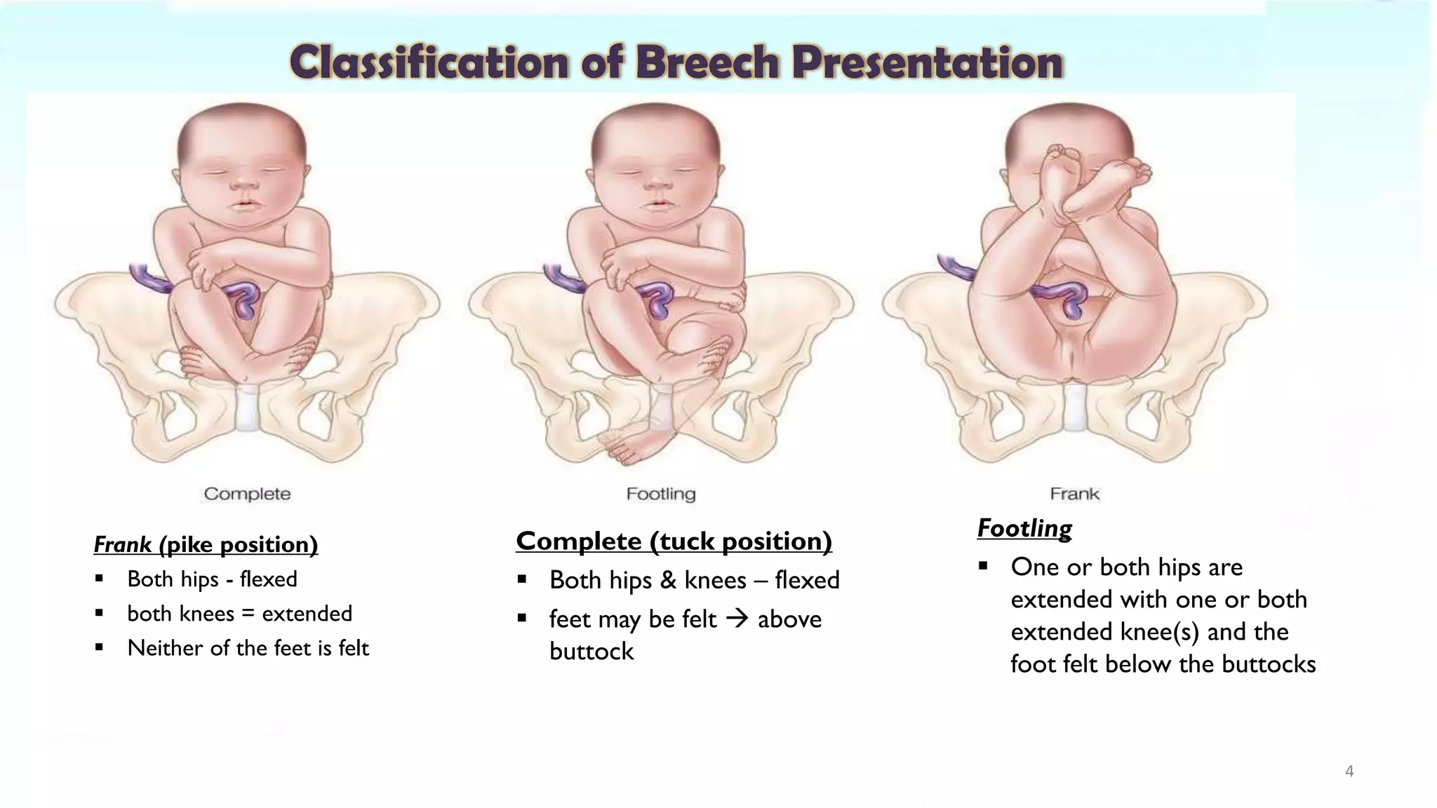 Classification of Breech Presentation
Frank (pike position)
▪ Both hips - flexed
▪ both knees = extended
▪ Neither of the feet is felt
Complete (tuck position)
▪ Both hips & knees – flexed
▪ feet may be felt → above
buttock
Footling
▪ One or both hips are
extended with one or both
extended knee(s) and the
foot felt below the buttocks
4
 