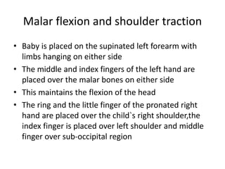 Malar flexion and shoulder traction
• Baby is placed on the supinated left forearm with
limbs hanging on either side
• The middle and index fingers of the left hand are
placed over the malar bones on either side
• This maintains the flexion of the head
• The ring and the little finger of the pronated right
hand are placed over the child`s right shoulder,the
index finger is placed over left shoulder and middle
finger over sub-occipital region
 