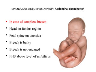 Breech presentation, types and its management | PPTX