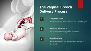 breech delivery by fortune teller_birth day | PPT