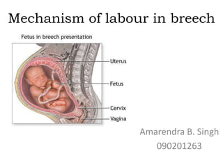 Mechanism of labour in breech
Amarendra B. Singh
090201263
 