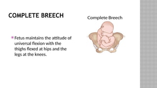 COMPLETE BREECH
 Fetus maintains the attitude of
universal flexion with the
thighs flexed at hips and the
legs at the knees.
 