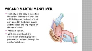 WIGAND MARTIN MANEUVER
 The body of the baby is placed on
the arm of the operator with the
middle finger of the hand of that
arm placed in the baby’s mouth
and the index and ring fingers on
the malar bones
 Maintain flexion.
 With the other hand, the
obstetrician exerts suprapubic
pressure on the head through the
mother’s abdomen
 