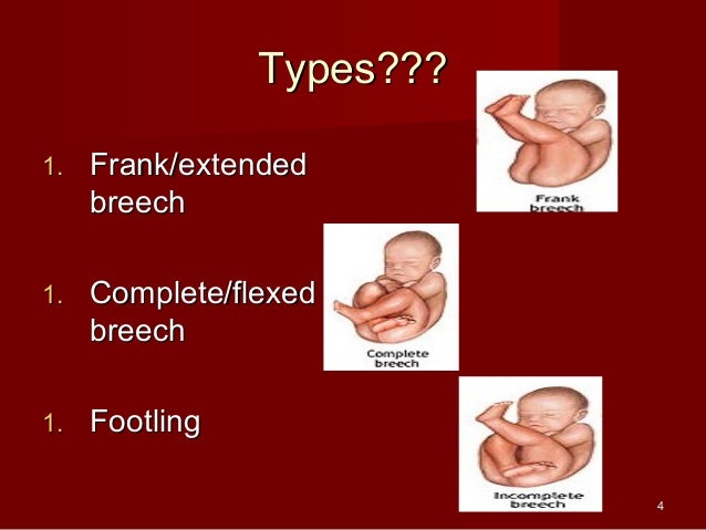 Breech