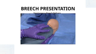 Breech Delivery Contraindication.ARB.pptx