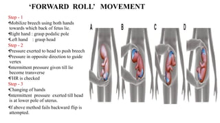 Breech ppt.pptx presentation............ | PPTX