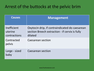Arrest of the buttocks at the pelvic brimwww.freelivedoctor.com