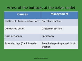 Arrest of the buttocks at the pelvic outletwww.freelivedoctor.com