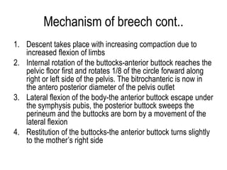 Breech presentation.pptx