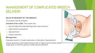 Breech Presentation.pdf DIPHU MEDICAL COLLEGE AND HOSPITAL | PDF