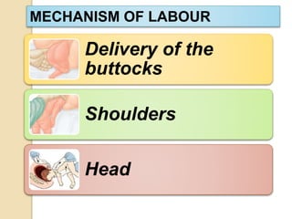 MECHANISM OF LABOUR 
Delivery of the 
buttocks 
Shoulders 
Head 
 