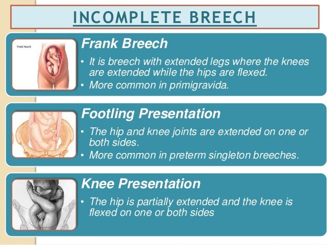 how-to-turn-breech-baby-instantly-8-exercises-to-turn-breech-baby