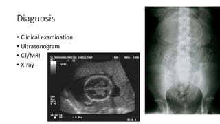Diagnosis
• Clinical examination
• Ultrasonogram
• CT/MRI
• X-ray
 