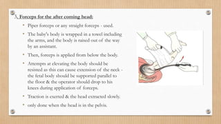 BREECH PRESENTATION obstetrics and gynacology mbbs final year | PPTX