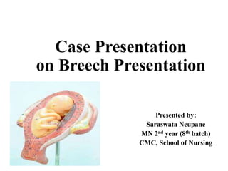 Case Presentation
on Breech Presentation
Presented by:
Saraswata Neupane
MN 2nd year (8th batch)
CMC, School of Nursing
 