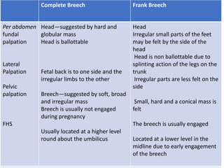 Breech presentation (2) | PPTX