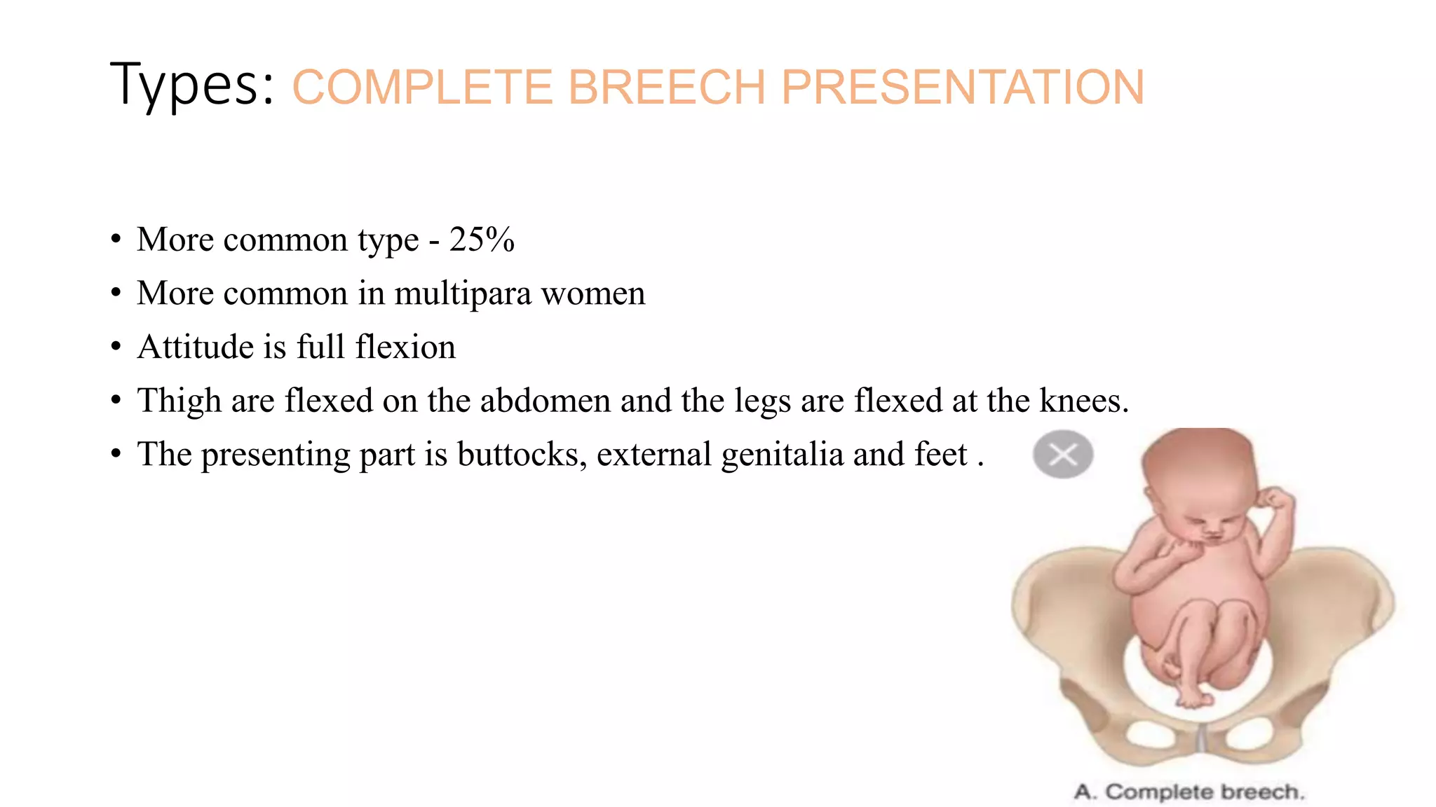 Breech Types Presentation