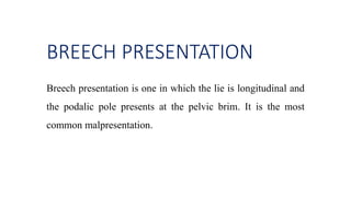 BREECH PRESENTATION
Breech presentation is one in which the lie is longitudinal and
the podalic pole presents at the pelvic brim. It is the most
common malpresentation.
 