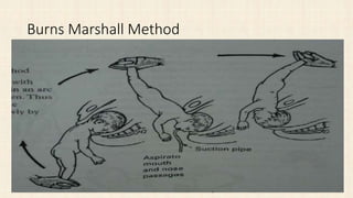 Burns Marshall Method
 