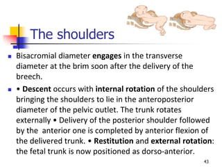 Breech presentation | PPTX