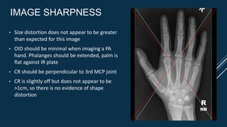 IMAGE SHARPNESS
• Size distortion does not appear to be greater
than expected for this image
• OID should be minimal when imaging a PA
hand. Phalanges should be extended, palm is
flat against IR plate
• CR should be perpendicular to 3rd MCP joint
• CR is slightly off but does not appear to be
>1cm, so there is no evidence of shape
distortion
R
NB
 