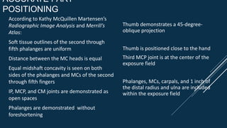 ACCURATE PART
POSITIONING
According to Kathy McQuillen Martensen’s
Radiographic Image Analysis and Merrill’s
Atlas:
Soft tissue outlines of the second through
fifth phalanges are uniform
Distance between the MC heads is equal
Equal midshaft concavity is seen on both
sides of the phalanges and MCs of the second
through fifth fingers
IP, MCP, and CM joints are demonstrated as
open spaces
Phalanges are demonstrated without
foreshortening
Thumb demonstrates a 45-degree-
oblique projection
Thumb is positioned close to the hand
Third MCP joint is at the center of the
exposure field
Phalanges, MCs, carpals, and 1 inch of
the distal radius and ulna are included
within the exposure field
 