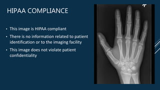 HIPAA COMPLIANCE
• This image is HIPAA compliant
• There is no information related to patient
identification or to the imaging facility
• This image does not violate patient
confidentiality
 