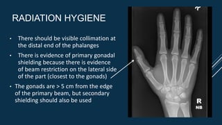 RADIATION HYGIENE
• There should be visible collimation at
the distal end of the phalanges
• There is evidence of primary gonadal
shielding because there is evidence
of beam restriction on the lateral side
of the part (closest to the gonads)
• The gonads are > 5 cm from the edge
of the primary beam, but secondary
shielding should also be used R
NB
 