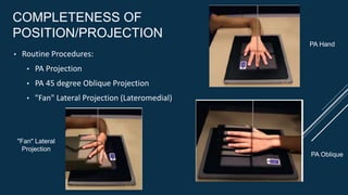 COMPLETENESS OF
POSITION/PROJECTION
• Routine Procedures:
• PA Projection
• PA 45 degree Oblique Projection
• "Fan" Lateral Projection (Lateromedial)
PA Hand
PA Oblique
"Fan" Lateral
Projection
 